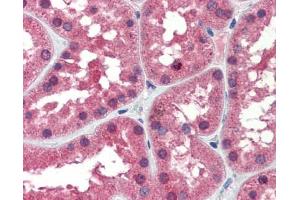 IDH1 antibody was used for immunohistochemistry at a concentration of 4-8 ug/ml. (IDH1 anticorps)