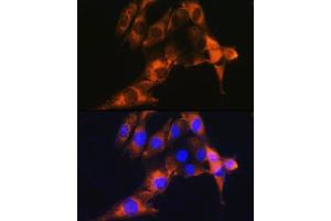 Immunofluorescence analysis of NIH/3T3 cells using CD13/CD13/ANPEP Rabbit pAb (ABIN6131185, ABIN6136911, ABIN6136912 and ABIN6221309) at dilution of 1:100.