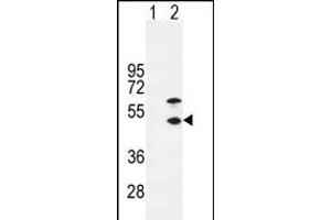 Western blot analysis of CKM (arrow) using rabbit polyclonal CKM-T6 (ABIN391095 and ABIN2841234). (CKM anticorps  (N-Term))