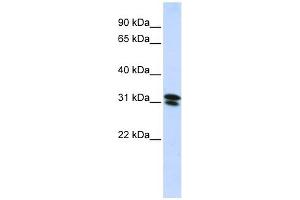 RNF182 antibody used at 1 ug/ml to detect target protein. (RNF182 anticorps  (N-Term))