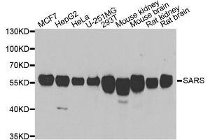 Western blot analysis of extracts of various cell lines, using SARS antibody. (Seryl-tRNA Synthetase (SARS) (AA 1-300) anticorps)