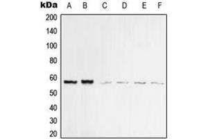 Western blot analysis of Vimentin expression in MCF7 (A), MDAMB435 (B), KNRK (C), HeLa (D), Raw264. (Vimentin anticorps  (C-Term))