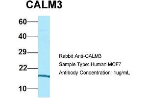 Host: Rabbit  Target Name: CALM3  Sample Tissue: Human MCF7  Antibody Dilution: 1. (Calmodulin 3 anticorps  (N-Term))