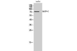 Western Blotting (WB) image for anti-Solute Carrier Organic Anion Transporter Family, Member 1B1 (SLCO1B1) (Internal Region) antibody (ABIN3185986) (SLCO1B1 anticorps  (Internal Region))