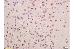 Formalin-fixed and paraffin embedded rat brain labeled with Rabbit Anti SOCS3 Polyclonal Antibody, Unconjugated (ABIN670416) at 1:200 followed by conjugation to the secondary antibody and DAB staining (SOCS3 anticorps  (AA 155-225))