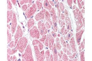 Anti-PTGIS antibody IHC of human heart.