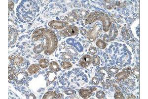 Image no. 1 for anti-DCTP Pyrophosphatase 1 (DCTPP1) (C-Term) antibody (ABIN6738241) (DCTPP1 anticorps  (C-Term))