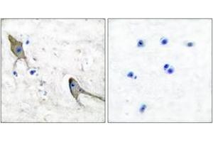 Immunohistochemistry analysis of paraffin-embedded human brain tissue, using PYK2 (Ab-881) Antibody. (PTK2B anticorps  (AA 847-896))