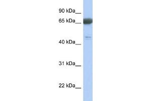 WB Suggested Anti-PNMA3 Antibody Titration: 0. (PNMA3 anticorps  (Middle Region))