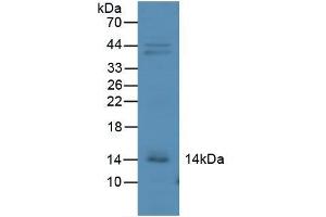 Detection of IP10 in Mouse Kidney Tissue using Polyclonal Antibody to Interferon Gamma Induced Protein 10 kDa (IP10) (CXCL10 anticorps  (AA 22-98))