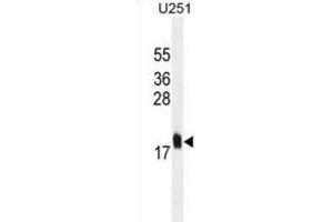 Western Blotting (WB) image for anti-Multiple Coagulation Factor Deficiency 2 (MCFD2) antibody (ABIN2995326)
