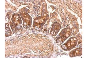 IHC-P Image eEF2 antibody detects eEF2 protein at cytosol on mouse intestine by immunohistochemical analysis.