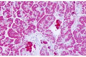 Image no. 2 for anti-Lysophospholipase-Like Protein 1 (LYPLAL1) (C-Term) antibody (ABIN6749790) (LYPLAL1 anticorps  (C-Term))