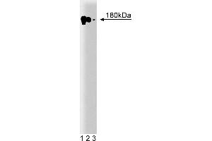 Western Blotting (WB) image for anti-Epidermal Growth Factor Receptor (EGFR) (AA 1020-1046) antibody (ABIN967697) (EGFR anticorps  (AA 1020-1046))