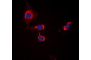 Immunofluorescent analysis of GABRB1 (pS434) staining in MCF7 cells. (GABRB1 anticorps  (C-Term, pSer434))