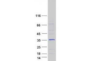 Validation with Western Blot