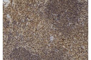 ABIN6276887 at 1/100 staining Mouse spleen tissue by IHC-P.