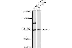 Western blot analysis of extracts of various cell lines, using GANC Rabbit pAb (ABIN7267406) at 1:1000 dilution. (GANC anticorps  (AA 100-200))