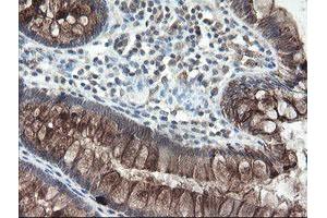 Image no. 13 for anti-Diphthamide Biosynthesis Protein 2 (DPH2) antibody (ABIN1497892)