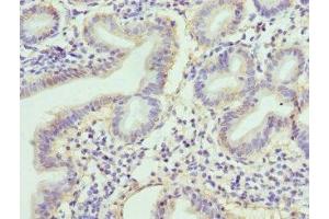Immunohistochemistry of paraffin-embedded human duodenal tissue using ABIN7167845 at dilution of 1:100 (RBP2 anticorps  (AA 1-134))