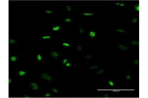 Immunofluorescence of monoclonal antibody to MEFV on HeLa cell. (MEFV anticorps  (AA 1-110))