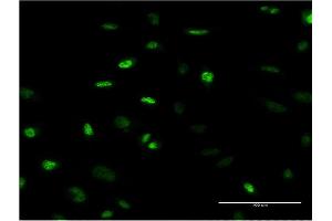 Immunofluorescence of monoclonal antibody to MEFV on HeLa cell.