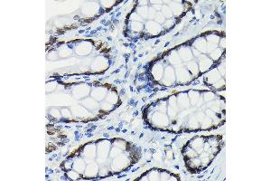 Immunohistochemistry of paraffin-embedded rat rectum using S Rabbit mAb (ABIN7270152) at dilution of 1:100 (40x lens). (SATB2 anticorps)
