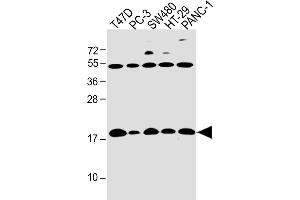 All lanes : Anti-IFITM5 Antibody (Center) at 1:4000 dilution Lane 1: T47D whole cell lysate Lane 2: PC-3 whole cell lysate Lane 3: S whole cell lysate Lane 4: HT-29 whole cell lysate Lane 5: NC-1 whole cell lysate Lysates/proteins at 20 μg per lane. (IFITM5 anticorps  (AA 55-83))