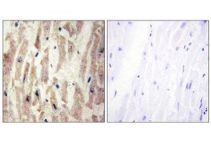 Immunohistochemistry (IHC) image for anti-Laminin, alpha 4 (LAMa4) (Internal Region) antibody (ABIN1850448) (LAMa4 anticorps  (Internal Region))