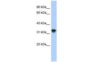 CENPP antibody used at 1 ug/ml to detect target protein. (CENPP anticorps  (N-Term))