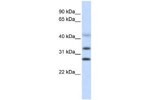 WB Suggested Anti-CENPH Antibody Titration: 0. (CENPH anticorps  (Middle Region))