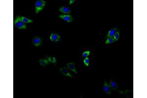Immunofluorescent analysis of HepG2 cells using ABIN7143307 at dilution of 1:100 and Alexa Fluor 488-congugated AffiniPure Goat Anti-Rabbit IgG(H+L) (Adenosine A2b Receptor anticorps  (AA 292-332))