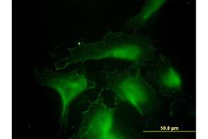 Immunofluorescence of monoclonal antibody to DNAJA4 on HeLa cell. (DNAJA4 anticorps  (AA 1-397))