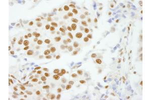 anti-Cleavage and Polyadenylation Specific Factor 1, 160kDa (CPSF1) (AA 1392-1442) antibody