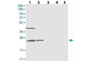 Western blot analysis of Lane 1: RT-4, Lane 2: U-251 MG, Lane 3: Human Plasma, Lane 4: Liver, Lane 5: Tonsil with UQCC polyclonal antibody  at 1:250-1:500 dilution. (Ubiquinol-Cytochrome C Reductase Complex Chaperone (UQCC) anticorps)