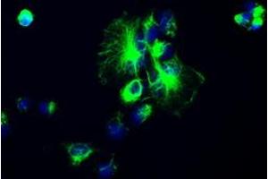 Image no. 2 for anti-Glial Fibrillary Acidic Protein (GFAP) antibody (ABIN1498437) (GFAP anticorps)