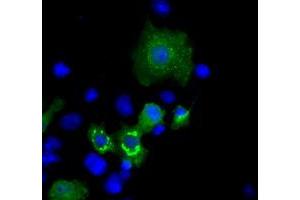 Image no. 1 for anti-Induced Myeloid Leukemia Cell Differentiation Protein Mcl-1 (MCL1) antibody (ABIN1499341)