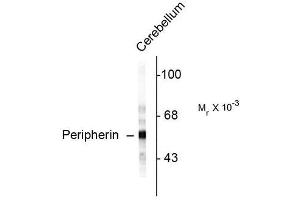 Image no. 1 for anti-Peripherin (PRPH) antibody (ABIN372702) (Peripherin anticorps)