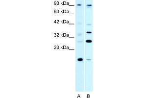 WB Suggested Anti-PAntibody Titration:  0. (PARP11 anticorps  (N-Term))