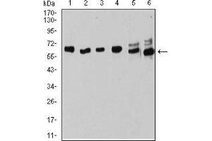 Western blot analysis using ESR1 mouse mAb against MOLT4 (1), Raji (2), MCF-7 (3), T47D (4), SK-Br-3 (5), and Hela (6) cell lysate. (Estrogen Receptor alpha anticorps  (AA 2-185))