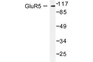 Image no. 1 for anti-Glutamate Receptor, Ionotropic, Kainate 1 (GRIK1) antibody (ABIN265438) (GRIK1 anticorps)