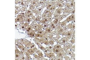 Immunohistochemistry of paraffin-embedded rat liver using ERK5 Rabbit pAb (ABIN3022944, ABIN3022945, ABIN3022946 and ABIN6219309) at dilution of 1:50 (40x lens). (MAPK7 anticorps  (AA 1-310))