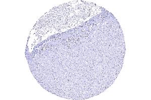 Liver showing a lack of 53BP1 staining in hepatocytes (Recombinant TP53BP1 anticorps  (C-Term))