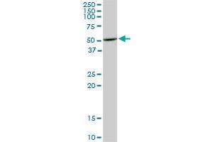 HDAC3 monoclonal antibody (M02), clone 3E11. (HDAC3 anticorps  (AA 319-428))