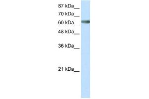 WB Suggested Anti-ZNF447 Antibody Titration: 0. (ZSCAN18 anticorps  (Middle Region))
