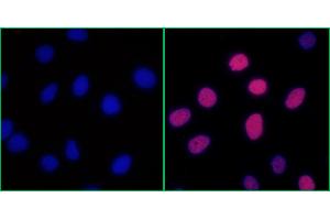 Immunofluorescence (IF) image for anti-Replication Protein A2, 32kDa (RPA2) (pSer4), (pSer8) antibody (ABIN7453379) (Recombinant RPA2 anticorps  (pSer4, pSer8))