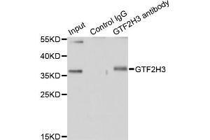 Immunoprecipitation analysis of 200 μg extracts of HT-29 cells using 1 μg GTF2H3 antibody (ABIN5974322). (GTF2H3 anticorps)