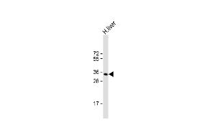 Anti-GNMT Antibody (Center) at 1:1000 dilution + human liver lysate Lysates/proteins at 20 μg per lane. (GNMT anticorps  (AA 78-106))