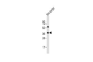 Anti-Nodal Antibody at 1:2000 dilution + SH-SY5Y whole cell lysates Lysates/proteins at 20 μg per lane.