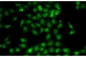 Immunofluorescence analysis of MCF7 cells using MBNL1 Polyclonal Antibody (MBNL1 anticorps)